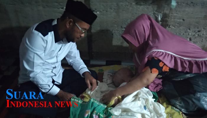 Datangi Kediaman Intan, Wabup Abdya Ajak Dermawan Bantu Biaya Pengobatan 
