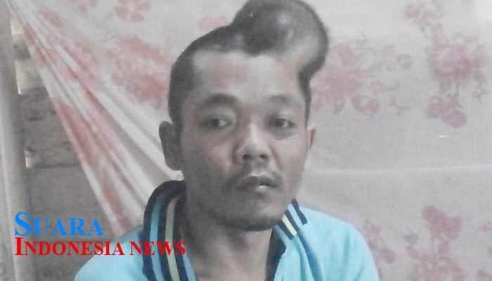 Sutrisno Penderita Tumor Otak Tutup Usia