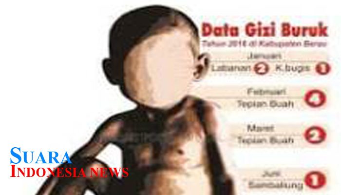 Minimalisir Gizi Buruk, Dinkes Pamekasan Minta Puskesmas Inten Sosialisasikan PIS-PK 8 Minimalisir Gizi Buruk, Dinkes Pamekasan Minta Puskesmas Inten Sosialisasikan PIS-PK