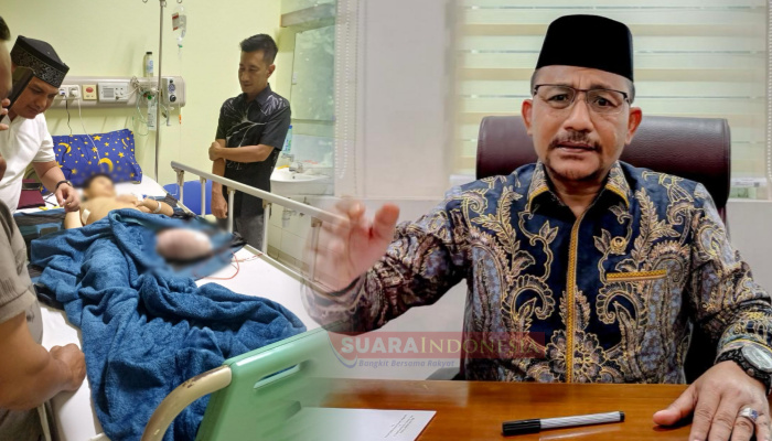 Haji Uma Beri Perhatian kepada Akmal Maha, Pasien Anak Penyintas Tumor Ganas Asal Subulussalam
